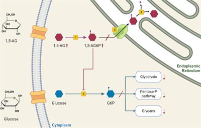 Current understanding on pathogenesis and effective treatment of glycogen storage disease type Ib with empagliflozin: new insights coming from diabetes for its potential implications in other metabolic disorders